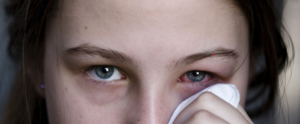 Read more about the article what is commonly misdiagnosed as pink eye