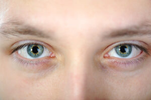 Read more about the article are blue eyes more sensitive to light