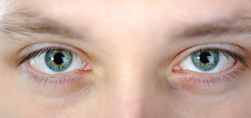 are blue eyes more sensitive to light